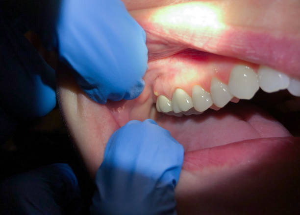 Best After-Hours Emergency Dentist in Peculiar, MO
